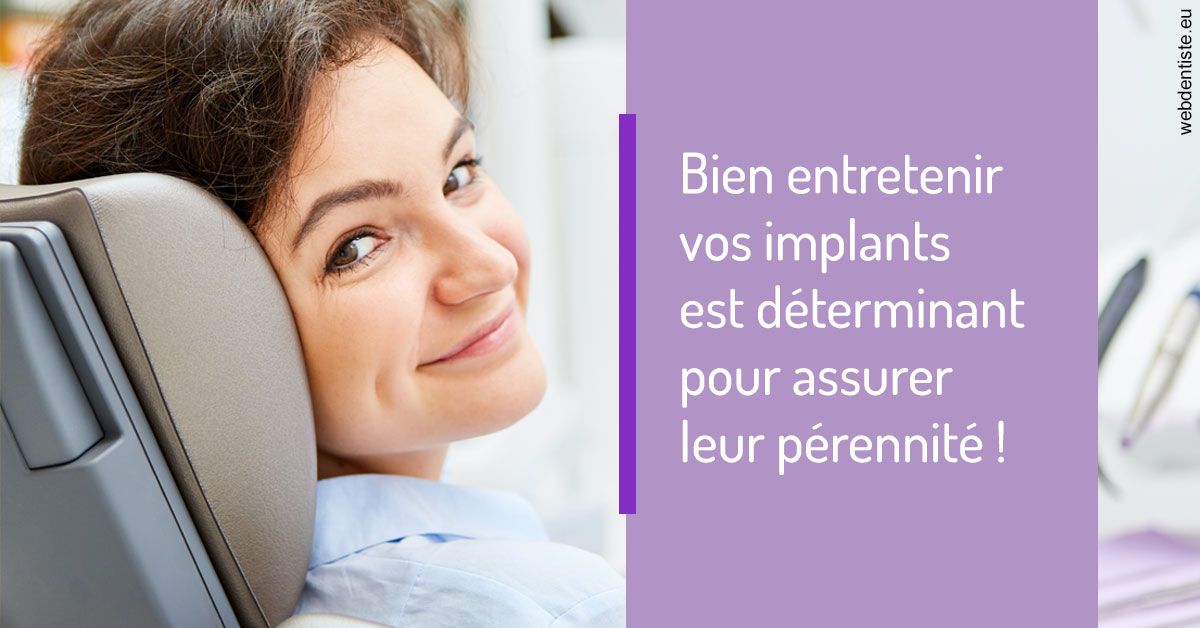 https://dr-olivier-pilz.chirurgiens-dentistes.fr/Entretien implants 1