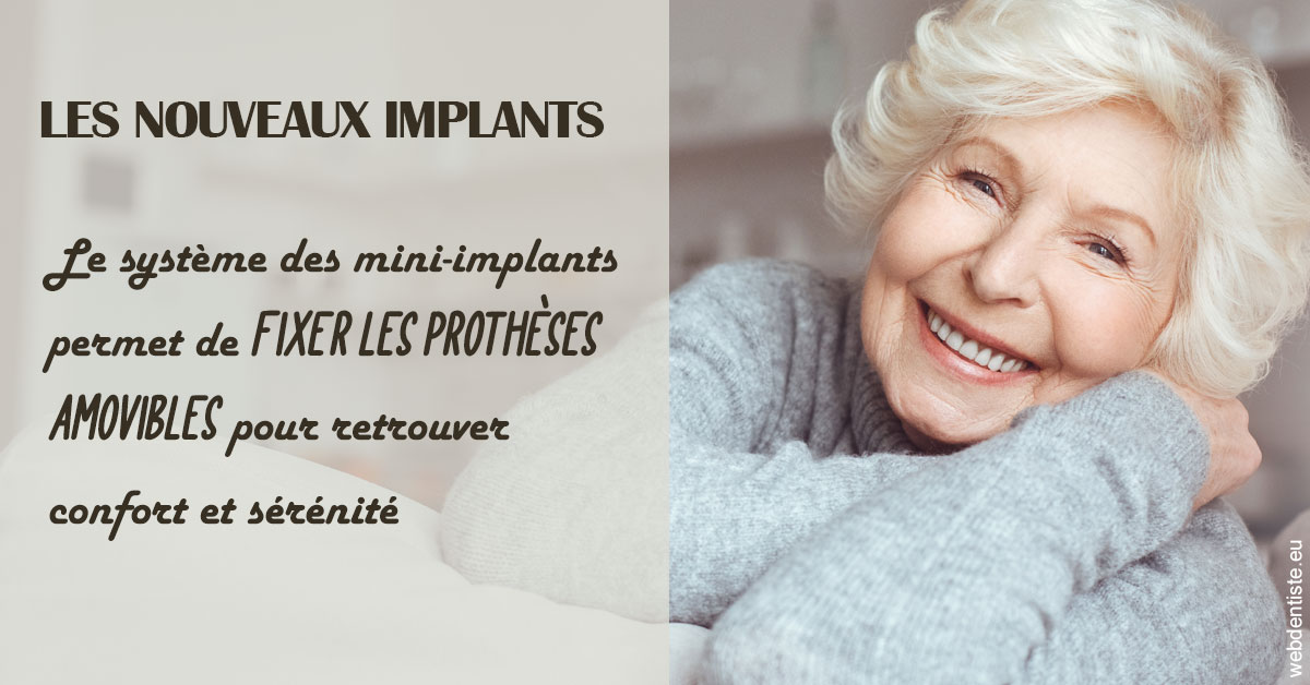 https://dr-olivier-pilz.chirurgiens-dentistes.fr/Les nouveaux implants 1