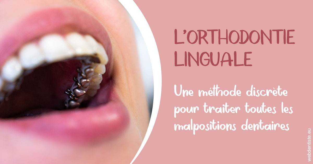 https://dr-olivier-pilz.chirurgiens-dentistes.fr/L'orthodontie linguale 2