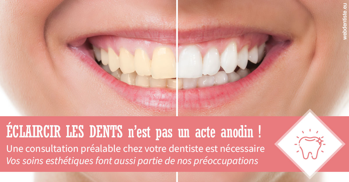 https://dr-olivier-pilz.chirurgiens-dentistes.fr/Eclaircir les dents 1
