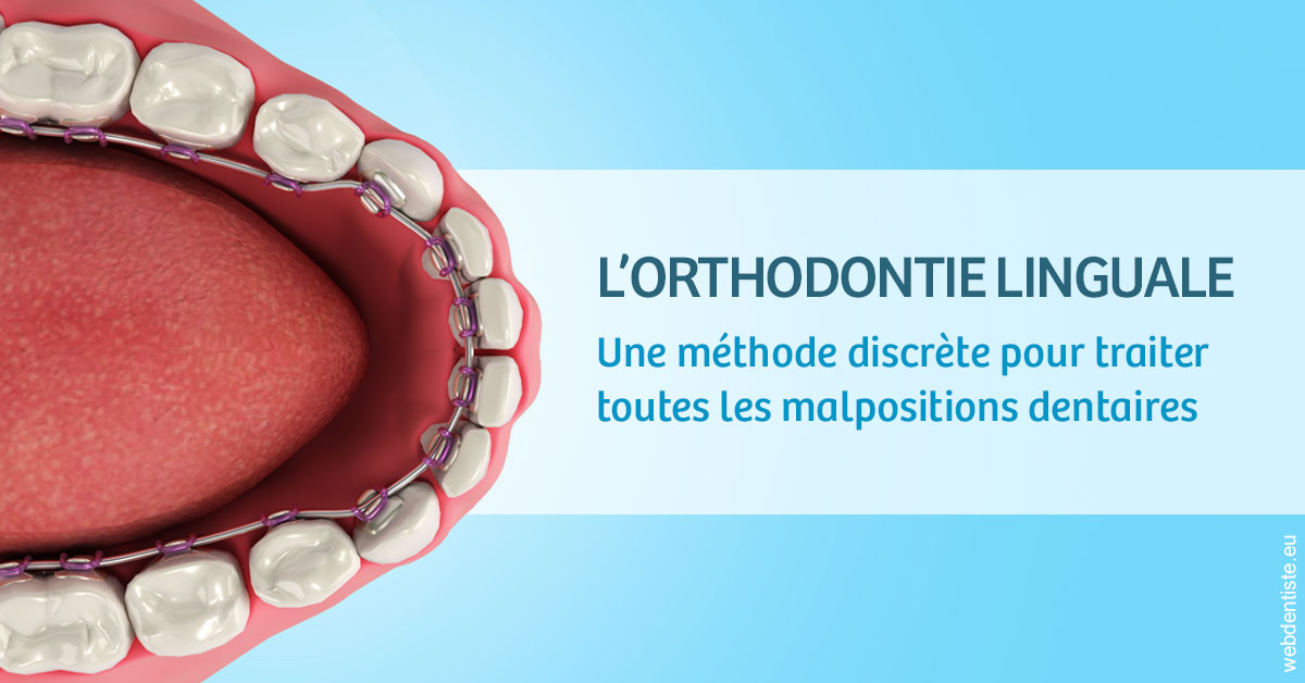 https://dr-olivier-pilz.chirurgiens-dentistes.fr/L'orthodontie linguale 1