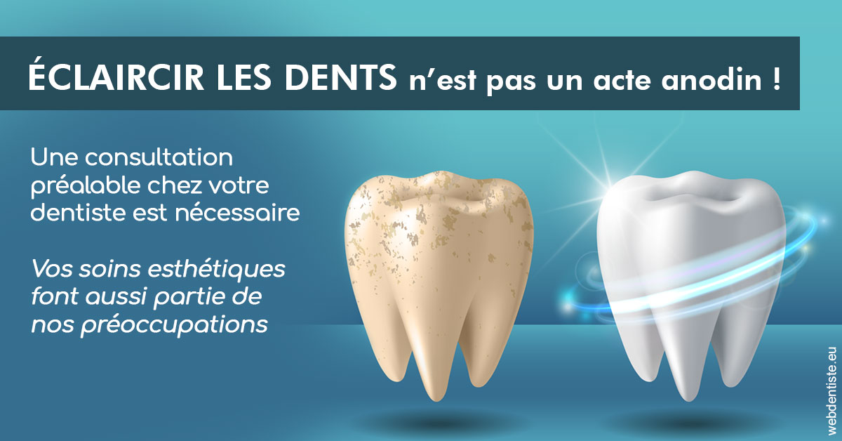https://dr-olivier-pilz.chirurgiens-dentistes.fr/Eclaircir les dents 2