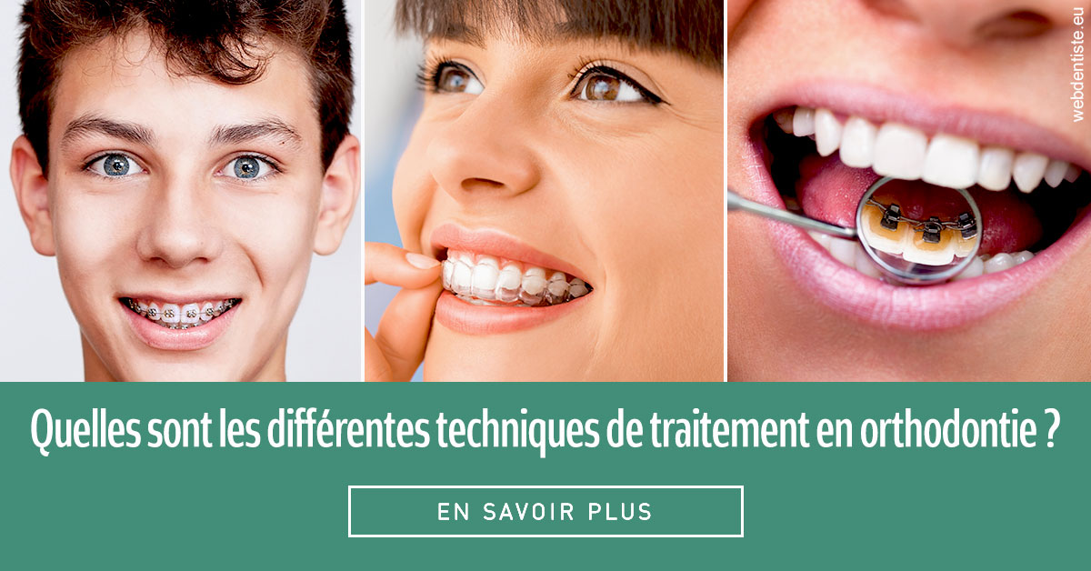 https://dr-olivier-pilz.chirurgiens-dentistes.fr/Les différentes techniques de traitement 2