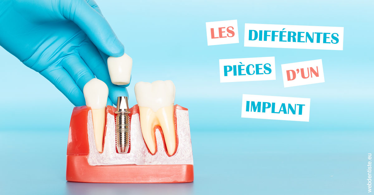 https://dr-olivier-pilz.chirurgiens-dentistes.fr/Les différentes pièces d’un implant 2
