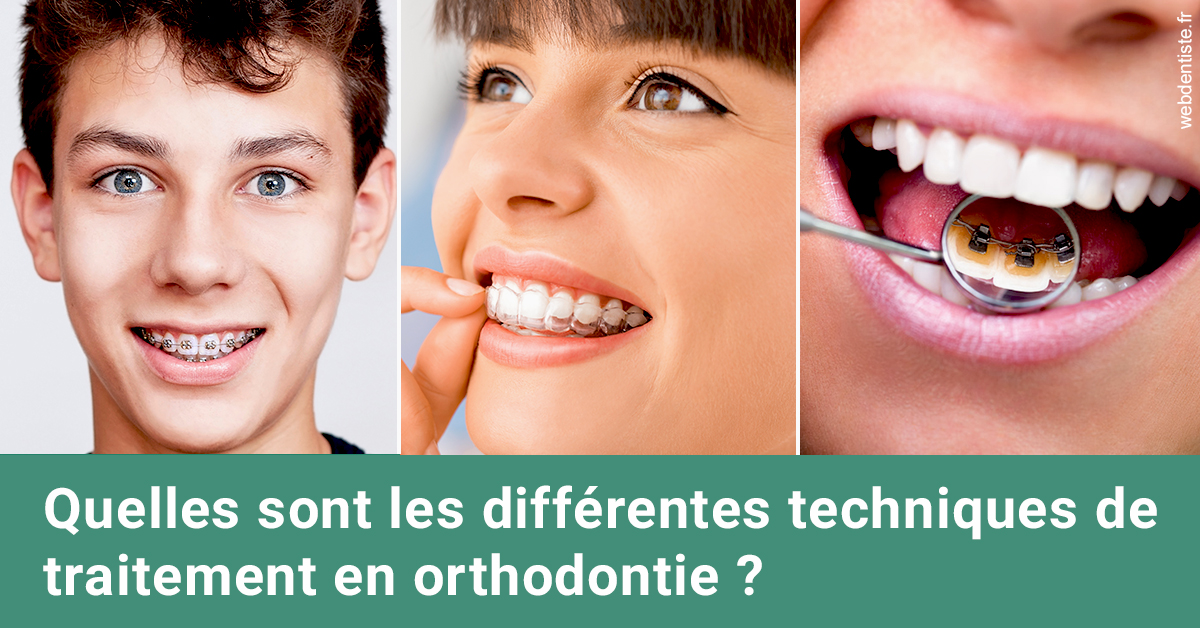 https://dr-olivier-pilz.chirurgiens-dentistes.fr/Les différentes techniques de traitement 2