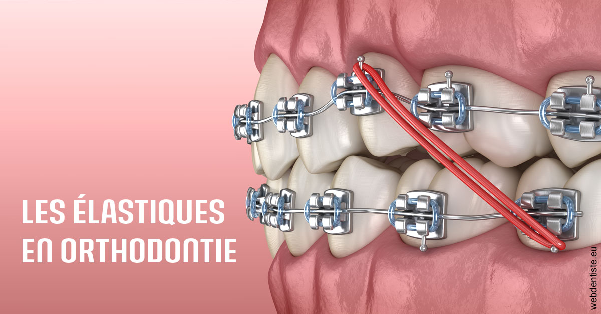 https://dr-olivier-pilz.chirurgiens-dentistes.fr/Elastiques orthodontie 2