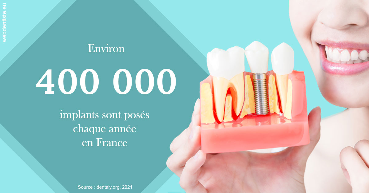 https://dr-olivier-pilz.chirurgiens-dentistes.fr/Pose d'implants en France 2